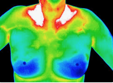 Medische thermografie
